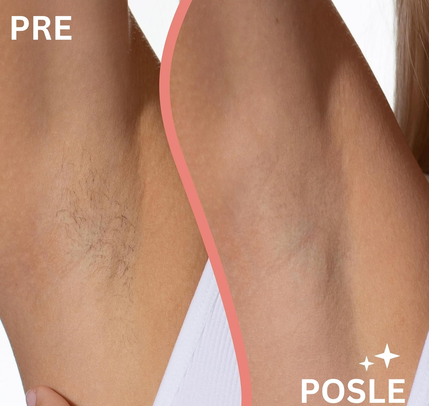 ELEKTRIČNI APARAT ZA BRIJANJE