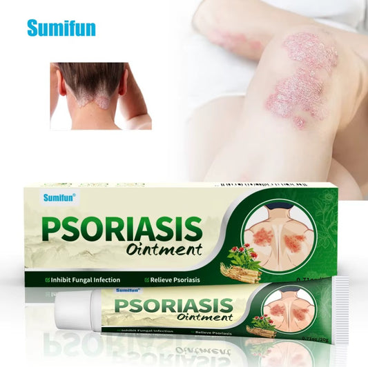 KREMA ZA PSORIJAZU